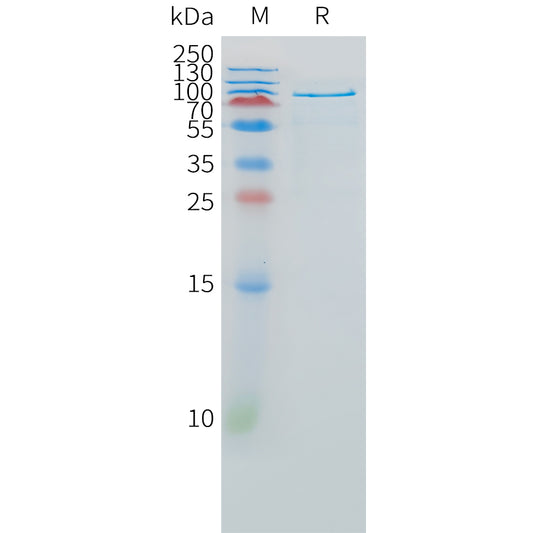 Human HGF(1-728) Protein, hFc Tag